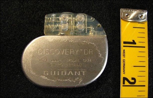 جهاز تنظيم ضربات القلب