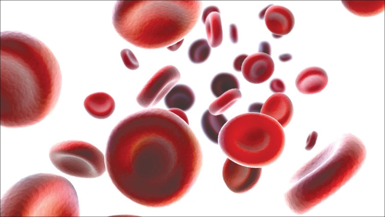 مرض الناعور