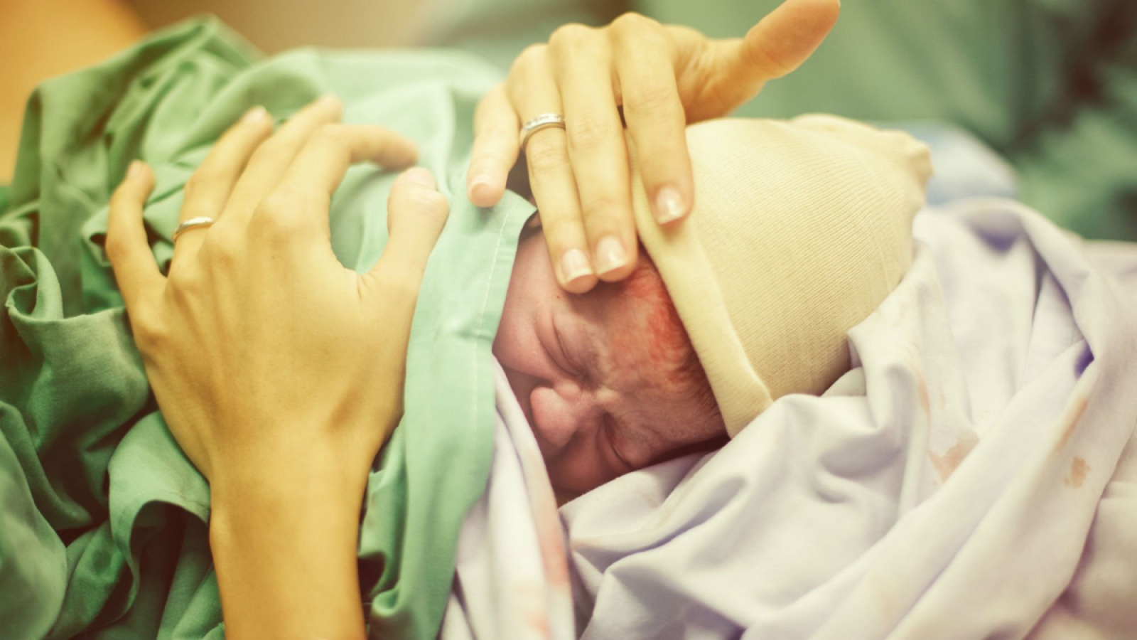 الولادة القيصرية