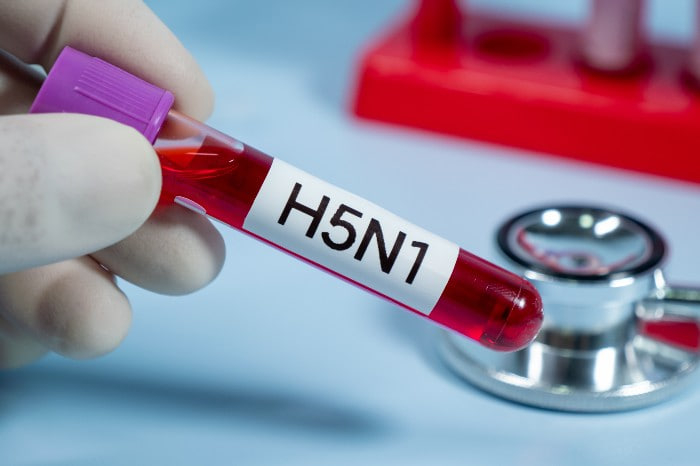 فيروس (H5N1)