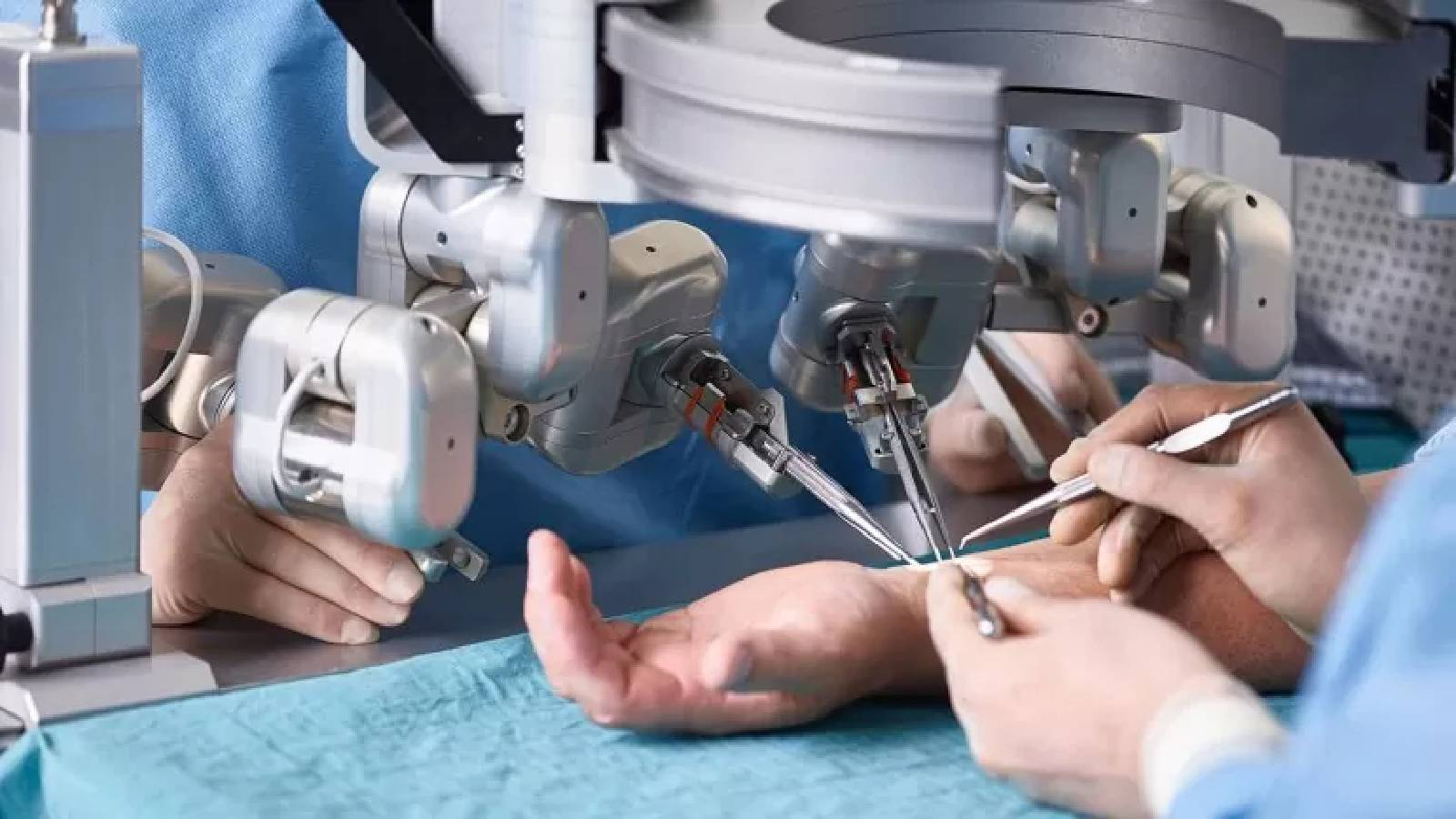 اطباء يجرون عملية جراحية في ذراع مريض باستخدام الروبوت الطبي 