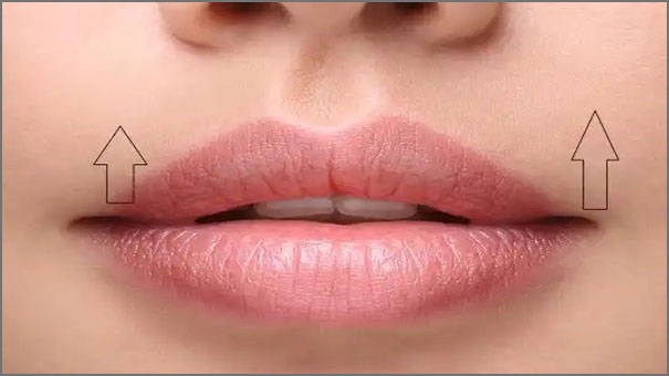 مخاطر عملية رفع الشفة العليا