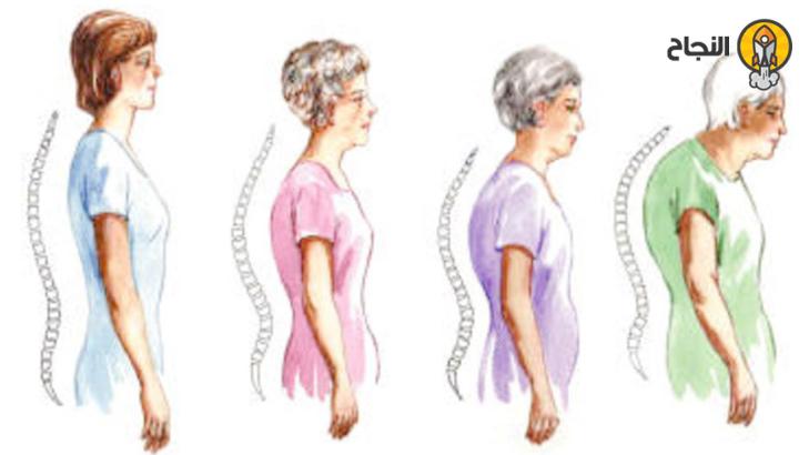 6 أغذية ضروريّة للوقاية من هشاشة العظام 6 أغذية ضروريّة للوقاية من هشاشة العظام