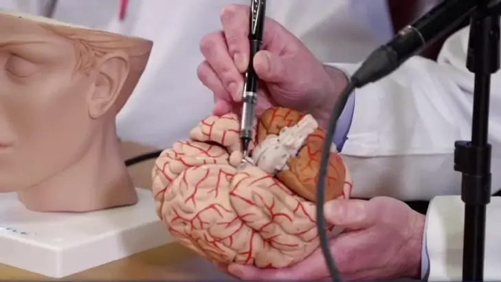 اضطرابات الغدة النُّخامية وتأثيرها في صحة المرأة: الأعراض والعلاج
