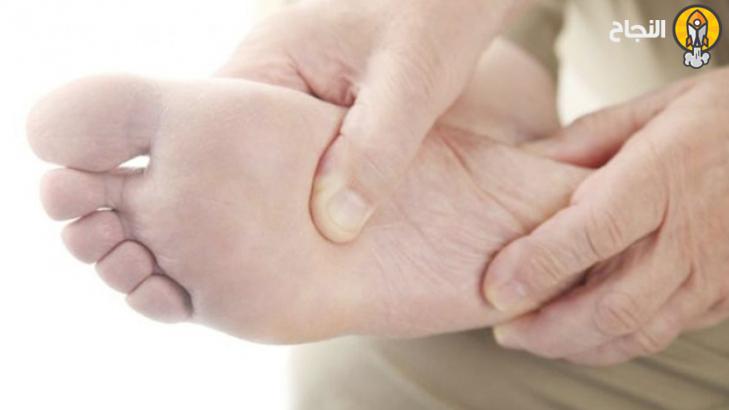 7 طرق طبيعية لإزالة مسامير اللحم من القدم