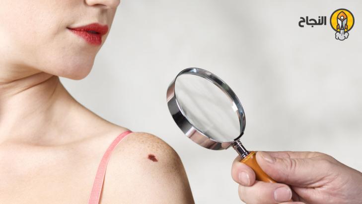 5 أعراض تدلّ على الإصابة بالسرطان