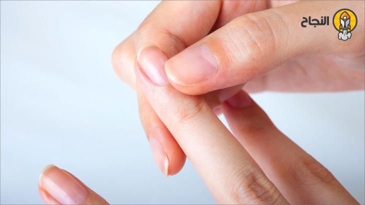 أشهر أمراض الأظافر ومشكلاتها وطرق علاجها أشهر أمراض الأظافر ومشكلاتها وطرق علاجها