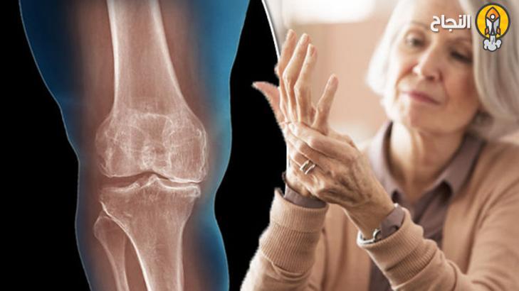 6 أسباب تقف وراء التهاب المفاصل