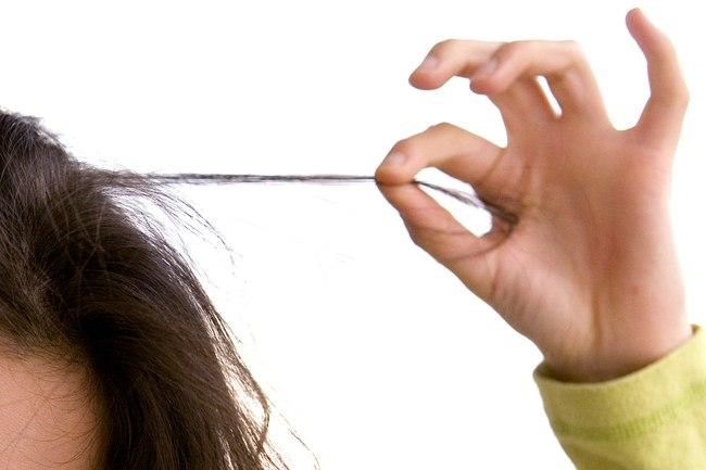 نزع الشّعر نزع الشّعر يؤدي لتساقط كبير في الشعر