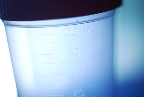 يطلب منك التبوّل في كأسٍ صغير