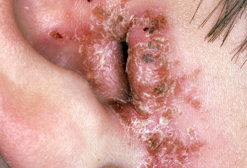 أُذُنُ السَّبَّاح