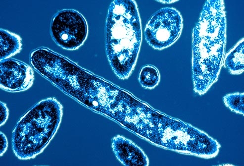 داء الليجونيلا