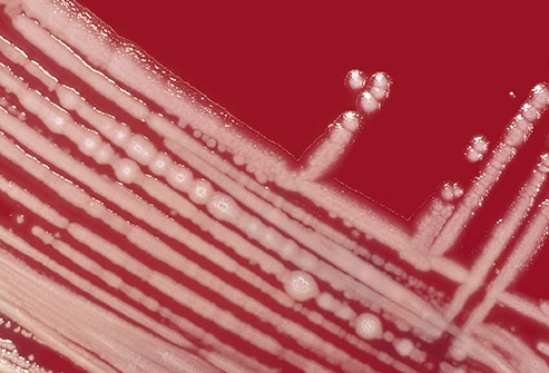 طفح الأنبوب الساخن