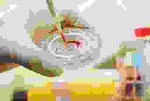 مرحلة ما بعد الإصابة بالإيبولا: