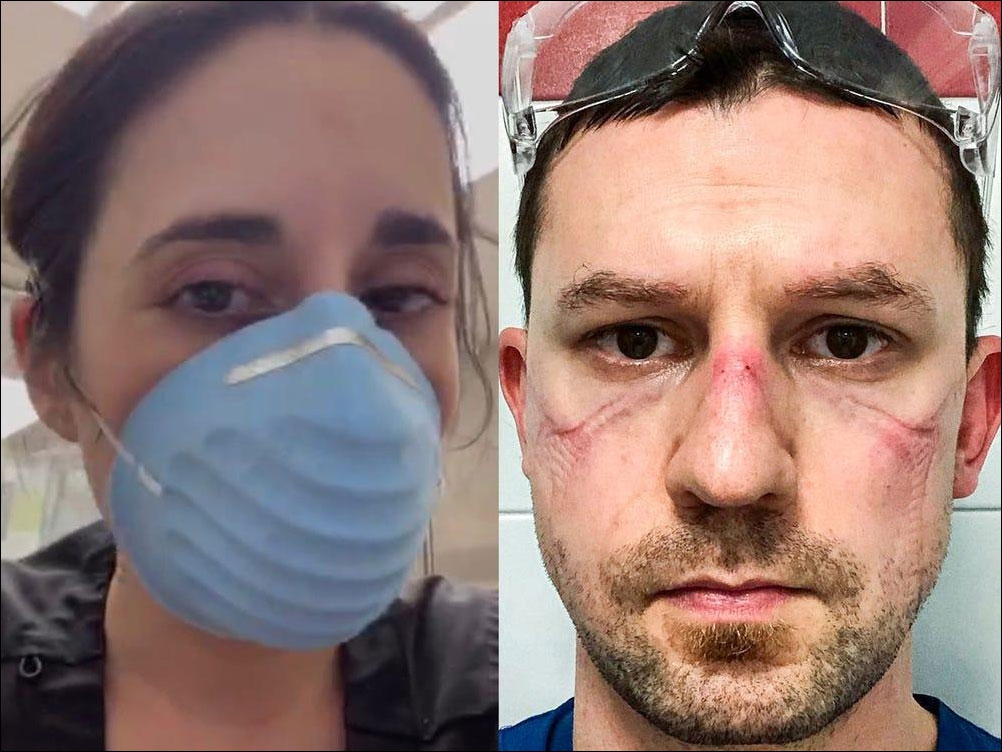 وجوه العاملين في مجال الرعاية الصحية بعد العمل مع مرضى فيروس كورونا لأيام